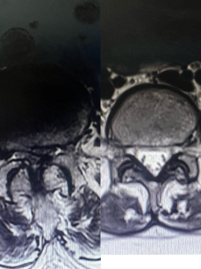 医讯怎么用【旗山医讯】人民的“医”靠 ｜ 巧用“神器”精准治疗，骨科团队连续啃下多块“硬骨头”_https://www.jmylbn.com_新闻资讯_第9张