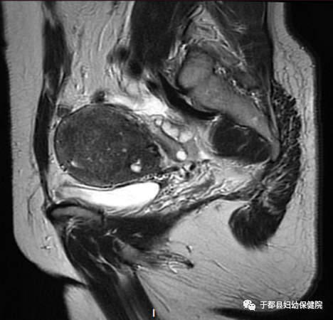 联影磁共振怎么样县妇保院引进联影1.5T超导高端磁共振_https://www.jmylbn.com_新闻资讯_第12张