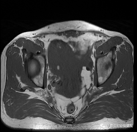 联影磁共振怎么样县妇保院引进联影1.5T超导高端磁共振_https://www.jmylbn.com_新闻资讯_第14张