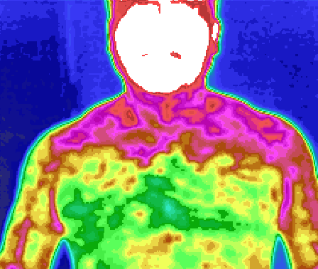 医用红外热像仪怎么开机中医“CT”——红外热像仪_https://www.jmylbn.com_新闻资讯_第5张