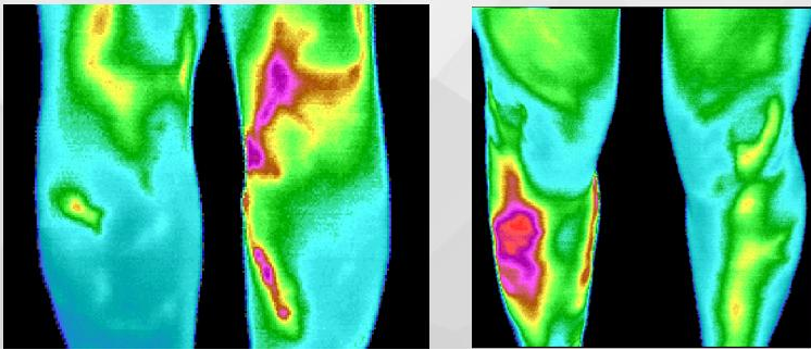 医用红外热像仪怎么开机中医“CT”——红外热像仪_https://www.jmylbn.com_新闻资讯_第4张