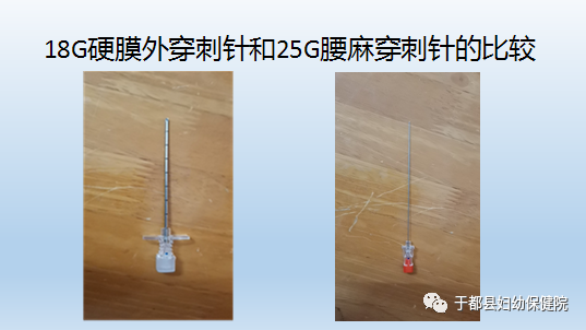 g穿刺怎么玩【新技术】25G腰麻穿刺细针进行单次腰麻在各类手术中的应用_https://www.jmylbn.com_新闻资讯_第4张