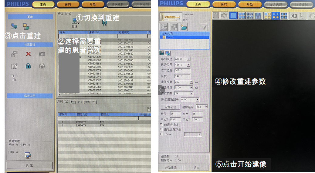 飞利浦ct有哪些型号飞利浦Access16&Mx16排CT常用操作（患者信息修改，图像离线重建，图像拷贝，刻盘，删除）_https://www.jmylbn.com_新闻资讯_第6张