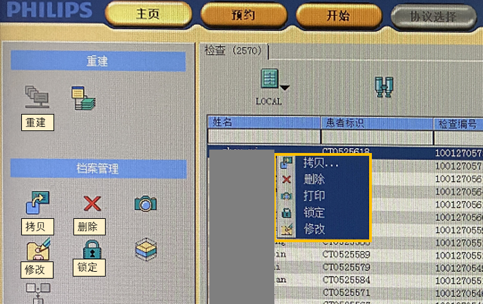飞利浦ct有哪些型号飞利浦Access16&Mx16排CT常用操作（患者信息修改，图像离线重建，图像拷贝，刻盘，删除）_https://www.jmylbn.com_新闻资讯_第2张
