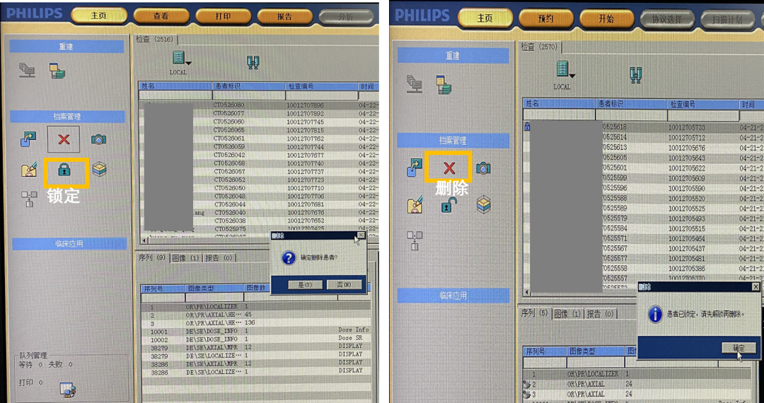 飞利浦ct有哪些型号飞利浦Access16&Mx16排CT常用操作（患者信息修改，图像离线重建，图像拷贝，刻盘，删除）_https://www.jmylbn.com_新闻资讯_第10张
