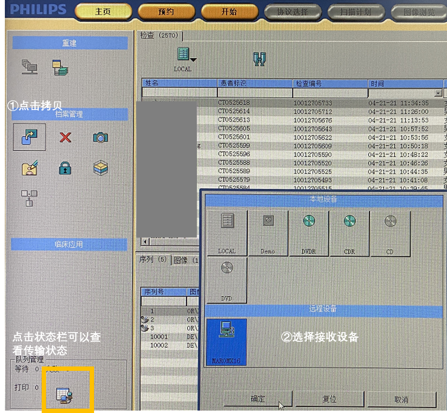 飞利浦ct有哪些型号飞利浦Access16&Mx16排CT常用操作（患者信息修改，图像离线重建，图像拷贝，刻盘，删除）_https://www.jmylbn.com_新闻资讯_第8张