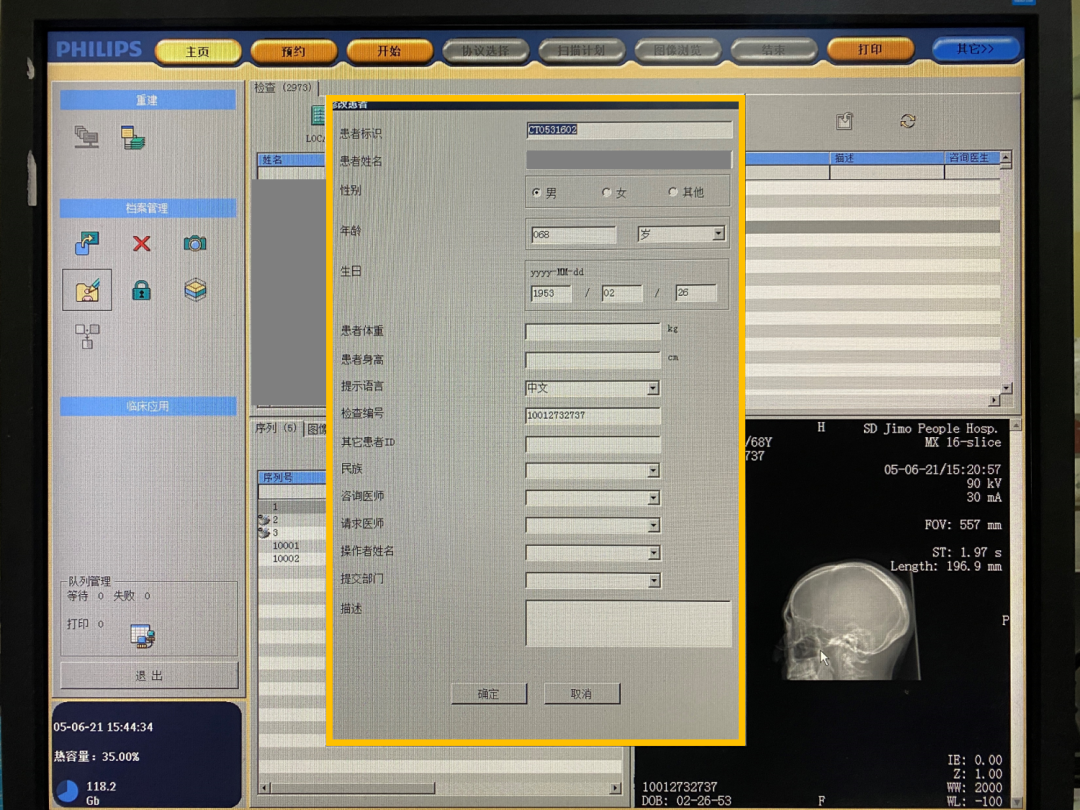 飞利浦ct有哪些型号飞利浦Access16&Mx16排CT常用操作（患者信息修改，图像离线重建，图像拷贝，刻盘，删除）_https://www.jmylbn.com_新闻资讯_第4张