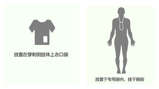 化疗为什么用泵关于便携式化疗泵，那些你想知道的事儿_https://www.jmylbn.com_新闻资讯_第5张