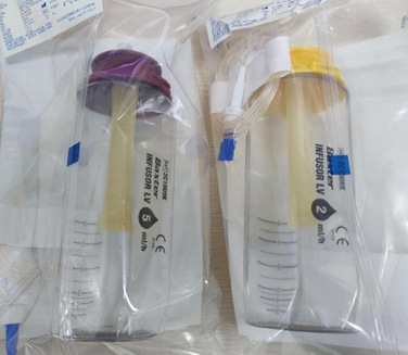 化疗为什么用泵关于便携式化疗泵，那些你想知道的事儿_https://www.jmylbn.com_新闻资讯_第3张