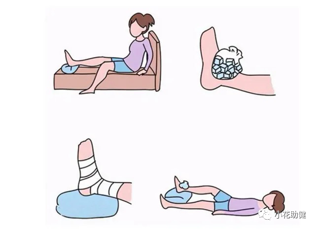 医用石膏夹板怎么用骨科常用治疗技术｜石膏固定术_https://www.jmylbn.com_新闻资讯_第4张