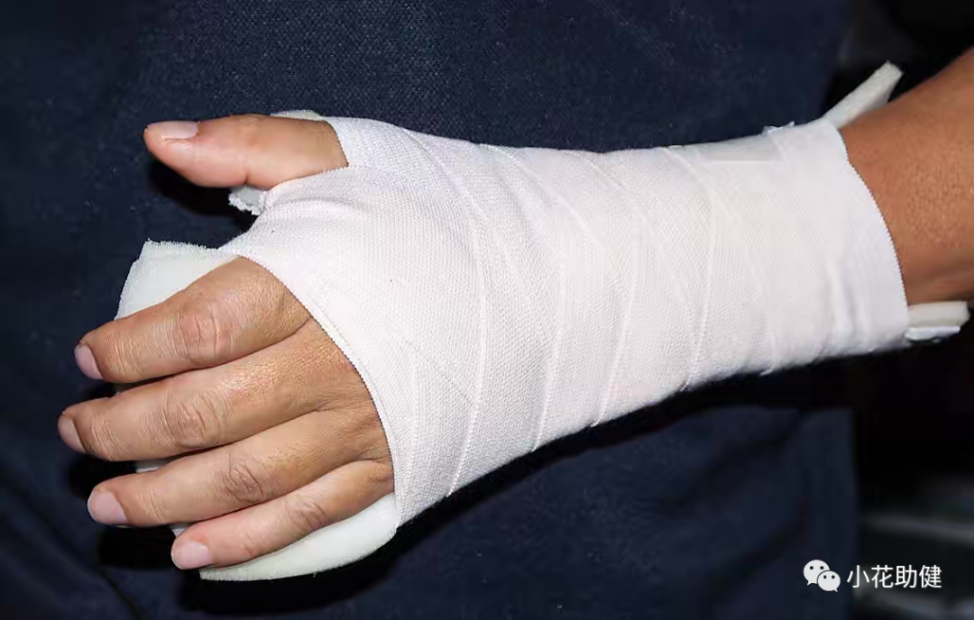 医用石膏夹板怎么用骨科常用治疗技术｜石膏固定术_https://www.jmylbn.com_新闻资讯_第1张