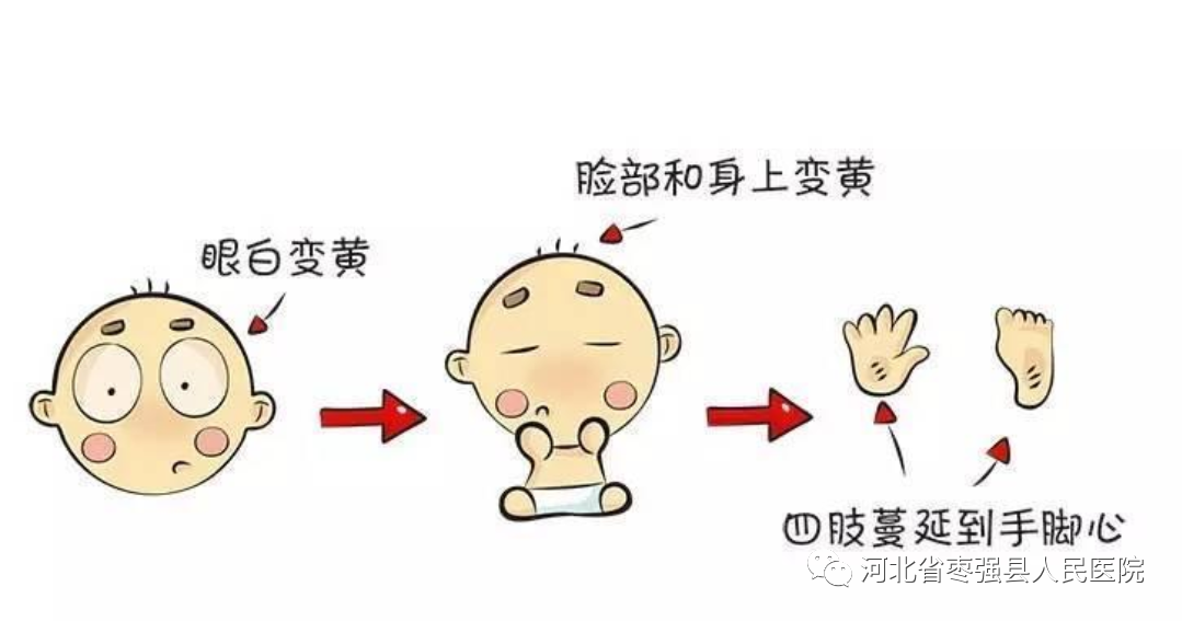 为什么要用光疗纸尿裤白天治疗，晚上回家！我院新生儿科日间光疗开诊啦！_https://www.jmylbn.com_新闻资讯_第14张