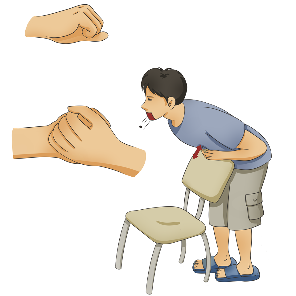 把握“黄金四分钟”！速看异物卡喉急救的正确方法！