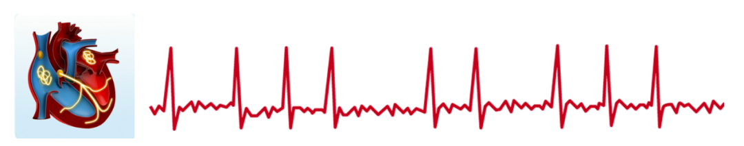 心脏检测仪怎么看中国房颤日｜ 穿戴式心电检测仪，心脏的守护神！（内有福利）_https://www.jmylbn.com_新闻资讯_第4张