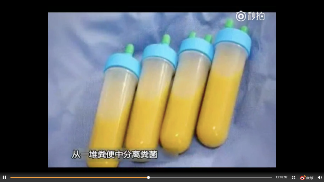 秃顶有救了？不过可能要吞屎才行...科学脑洞是无穷的（组图） - 11