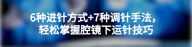 输尿管鞘是什么输尿管软镜碎石术的细节掌控_https://www.jmylbn.com_新闻资讯_第6张