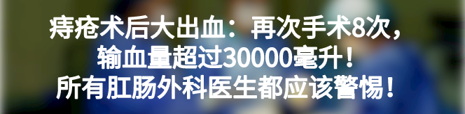 卵圆钳怎么持胸外科手术器械大汇总_https://www.jmylbn.com_新闻资讯_第29张