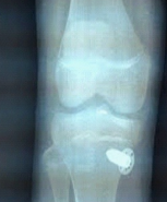 什么是血球仪快躺在手术台上了，看看你需要做些什么！_https://www.jmylbn.com_新闻资讯_第12张