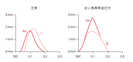 12导为什么是标准导联10分钟掌握标准心电图的基础知识_https://www.jmylbn.com_新闻资讯_第4张