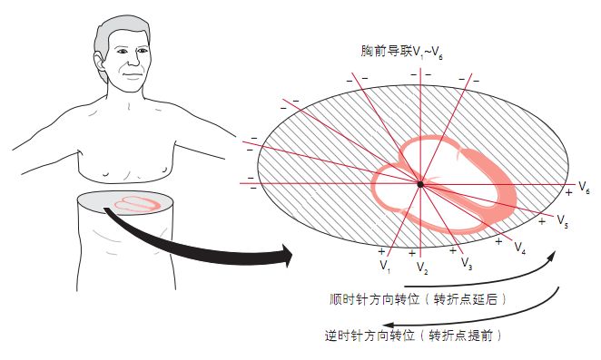 12导为什么是标准导联10分钟掌握标准心电图的基础知识_https://www.jmylbn.com_新闻资讯_第8张