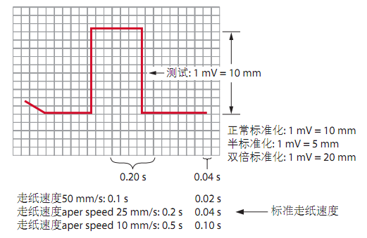 12导为什么是标准导联10分钟掌握标准心电图的基础知识_https://www.jmylbn.com_新闻资讯_第2张