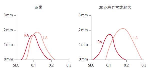 12导为什么是标准导联10分钟掌握标准心电图的基础知识_https://www.jmylbn.com_新闻资讯_第3张