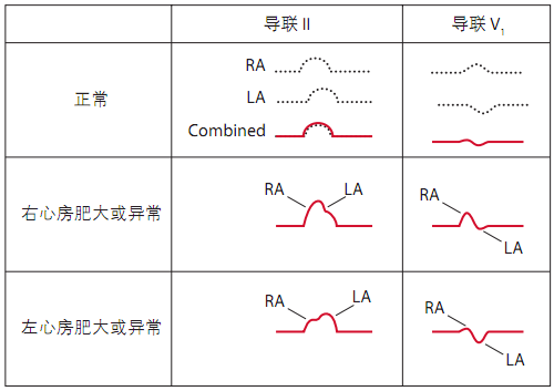 12导为什么是标准导联10分钟掌握标准心电图的基础知识_https://www.jmylbn.com_新闻资讯_第5张