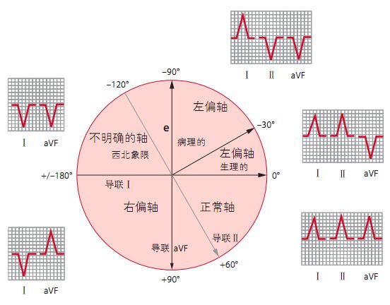 12导为什么是标准导联10分钟掌握标准心电图的基础知识_https://www.jmylbn.com_新闻资讯_第7张