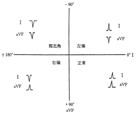 什么是同步心电图心电轴的测量方法，你掌握了几种？_https://www.jmylbn.com_新闻资讯_第11张