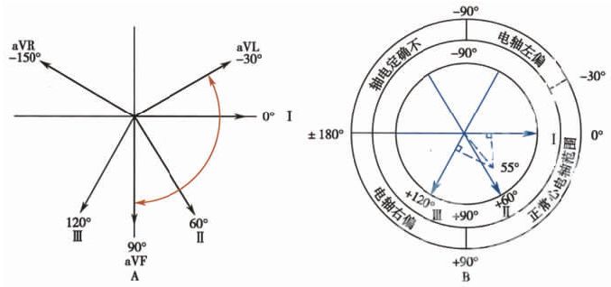 什么是同步心电图心电轴的测量方法，你掌握了几种？_https://www.jmylbn.com_新闻资讯_第13张