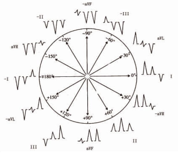 什么是同步心电图心电轴的测量方法，你掌握了几种？_https://www.jmylbn.com_新闻资讯_第6张