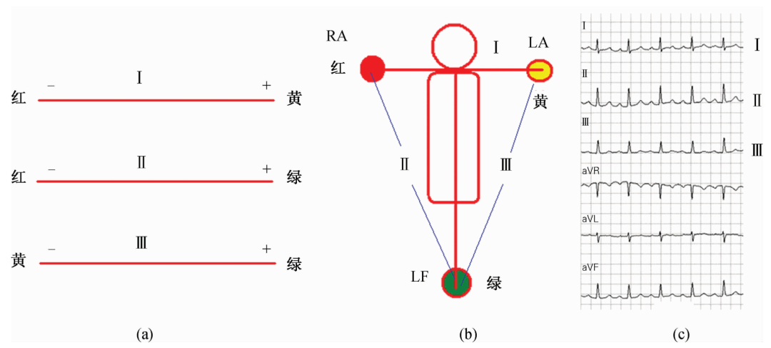 心电监护怎么看图心电图有问题？别急，先看看导联位置放对了吗_https://www.jmylbn.com_新闻资讯_第4张