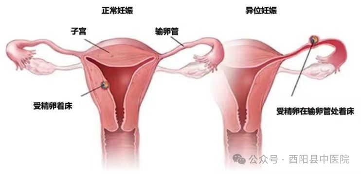 为什么不用切口保护套【首例！】我院妇产科成功开展切口保护套辅助下首例单孔腹腔镜手术！_https://www.jmylbn.com_新闻资讯_第11张