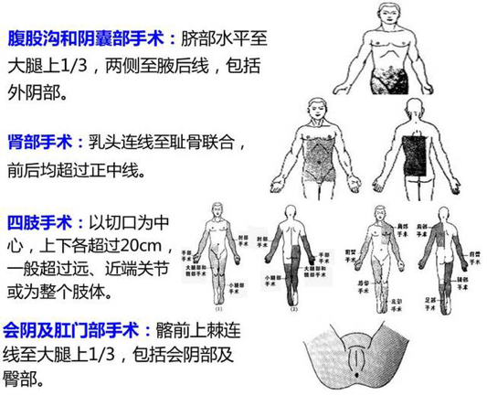 为什么要叫备皮刀“感术 ”行动 ｜｜ 院感说备皮刀不符合要求，备皮怎么办？常见备皮、消毒范围_https://www.jmylbn.com_新闻资讯_第2张
