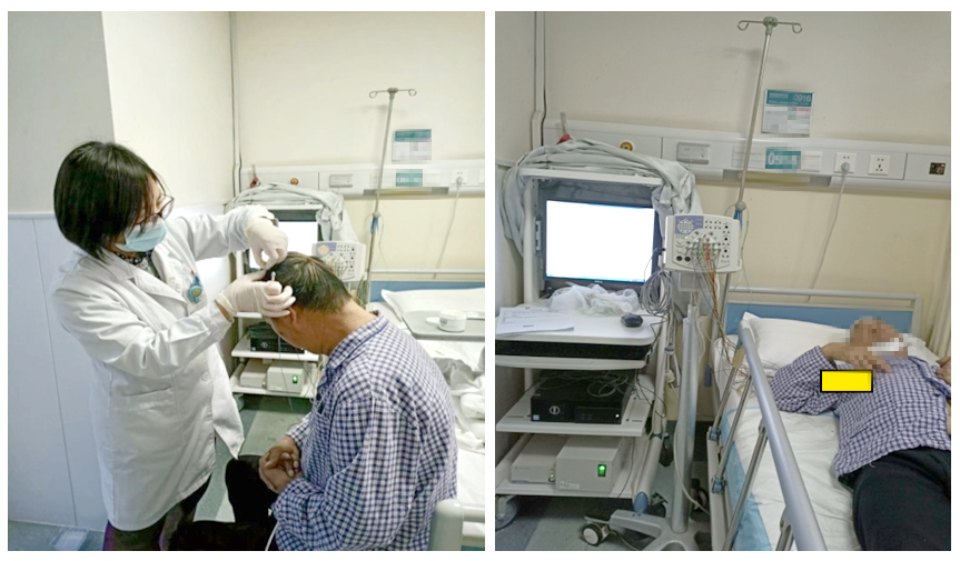 什么视频脑电图视频脑电监测是什么？哪些人需要做该检查？_https://www.jmylbn.com_新闻资讯_第2张