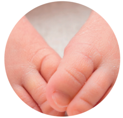 媽媽發現寶寶指甲有異狀？寶寶指甲不能亂剪！小心患上甲溝炎 親子 第3張