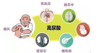 「五步走」規范治療高尿酸！ 健康 第3張