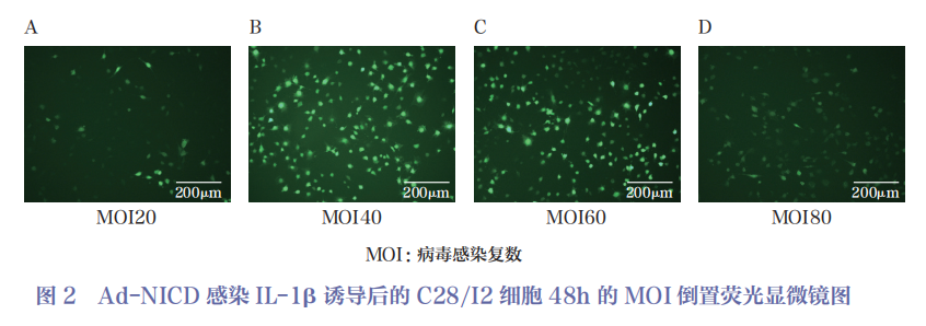 医用诱导骨基质是什么杂志文摘 ｜ Notch信号通路对骨关节炎软骨细胞增殖和软骨基质合成的作用研究_https://www.jmylbn.com_新闻资讯_第6张