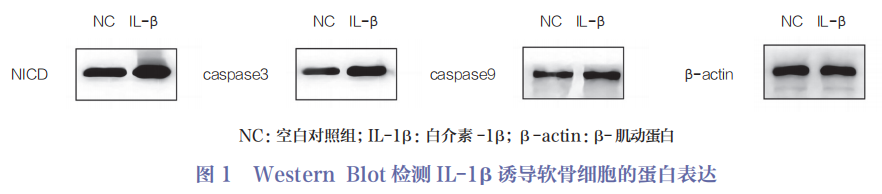 医用诱导骨基质是什么杂志文摘 ｜ Notch信号通路对骨关节炎软骨细胞增殖和软骨基质合成的作用研究_https://www.jmylbn.com_新闻资讯_第5张