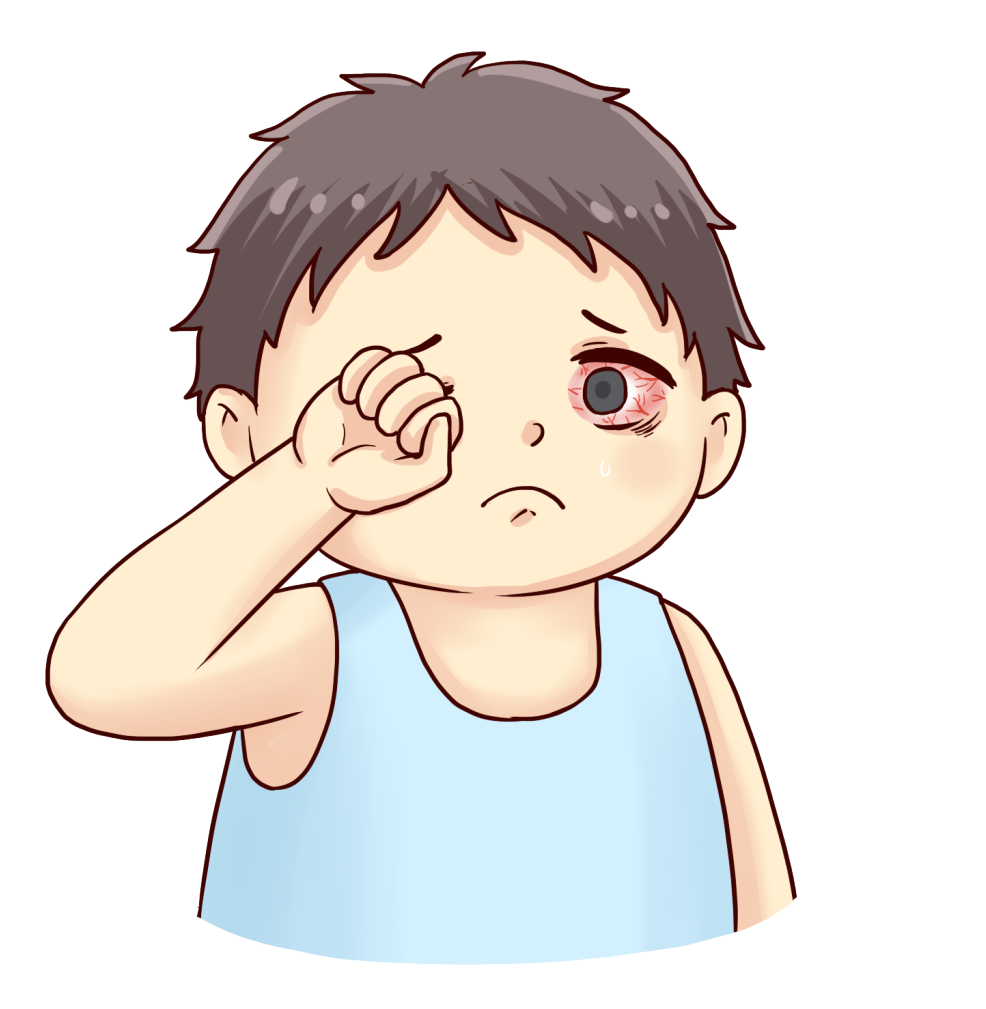 揉搓眼睛容易把手上的细菌带入眼睛,揉眼动作还会使角膜弧度不均,损伤