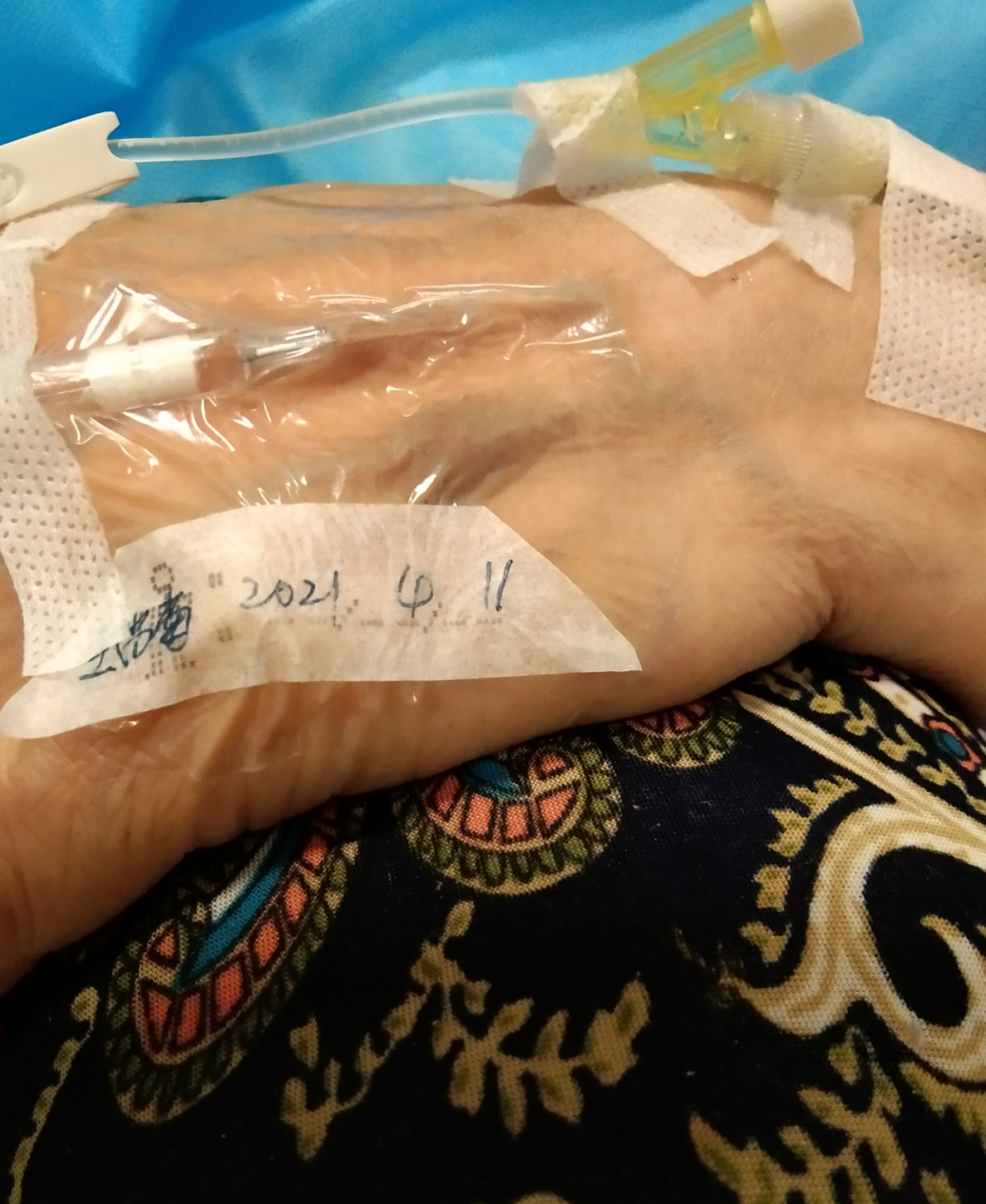 静脉留置针是干什么的留置针穿刺的最佳部位是哪里？别纠结，答案来了！_https://www.jmylbn.com_新闻资讯_第6张