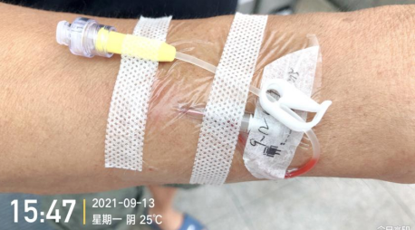 为什么国外不用y型留置针价格留置针一定要 U 型固定吗？这样做才是最合适的_https://www.jmylbn.com_新闻资讯_第6张