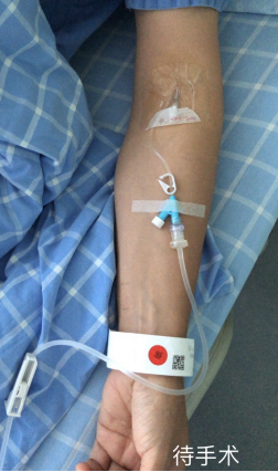 为什么国外不用y型留置针价格留置针一定要 U 型固定吗？这样做才是最合适的_https://www.jmylbn.com_新闻资讯_第9张