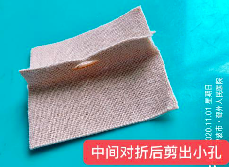 尿管怎么固定导尿管为什么要二次固定？看完视频我终于明白了_https://www.jmylbn.com_新闻资讯_第7张