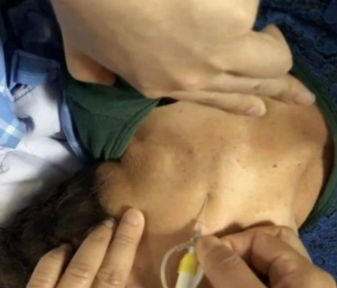 bd留置针怎么使用病人都休克了，留置针打不上怎么办？教你一招！_https://www.jmylbn.com_新闻资讯_第2张