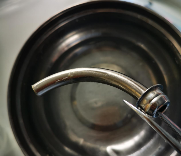 气管导管可用什么消毒金属气管内管，拔出困难怎么办？_https://www.jmylbn.com_新闻资讯_第4张