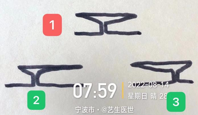 什么是医用导管固定贴导管固定总是出问题？教你 2 招，学会改良固定法_https://www.jmylbn.com_新闻资讯_第9张