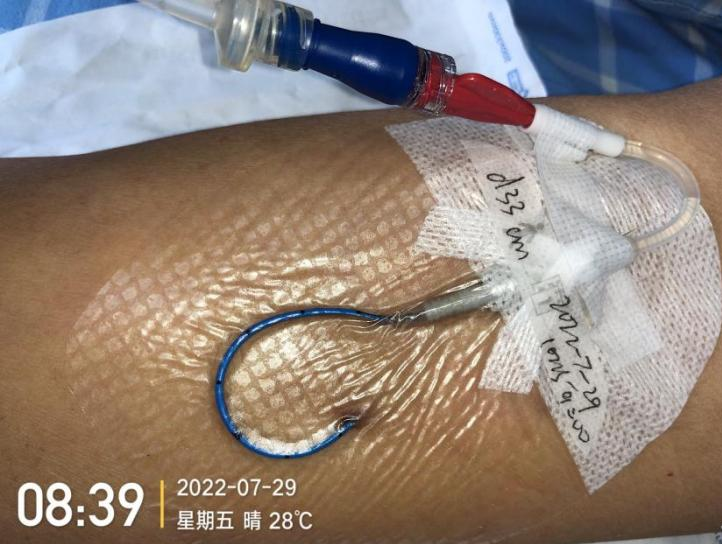 什么是医用导管固定贴导管固定总是出问题？教你 2 招，学会改良固定法_https://www.jmylbn.com_新闻资讯_第8张