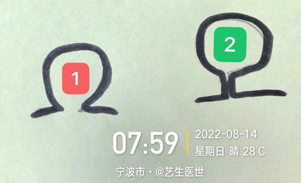 什么是医用导管固定贴导管固定总是出问题？教你 2 招，学会改良固定法_https://www.jmylbn.com_新闻资讯_第6张