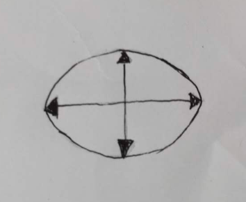 什么皮给药治​封闭治疗=皮下注射吗？药物外渗后的「封闭治疗」又是什么？_https://www.jmylbn.com_新闻资讯_第4张